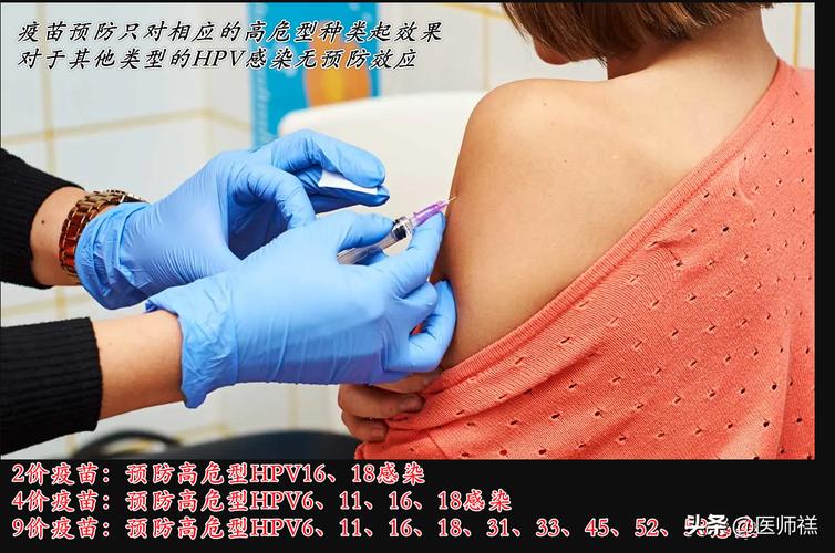 宮頸癌疫苗多少錢二價四價九價哪個值得打